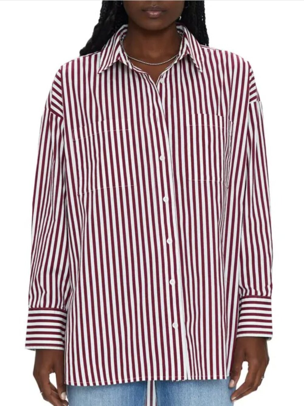 PISTOLA Rena Pink Striped Oversized Button Down Shirt Size Small